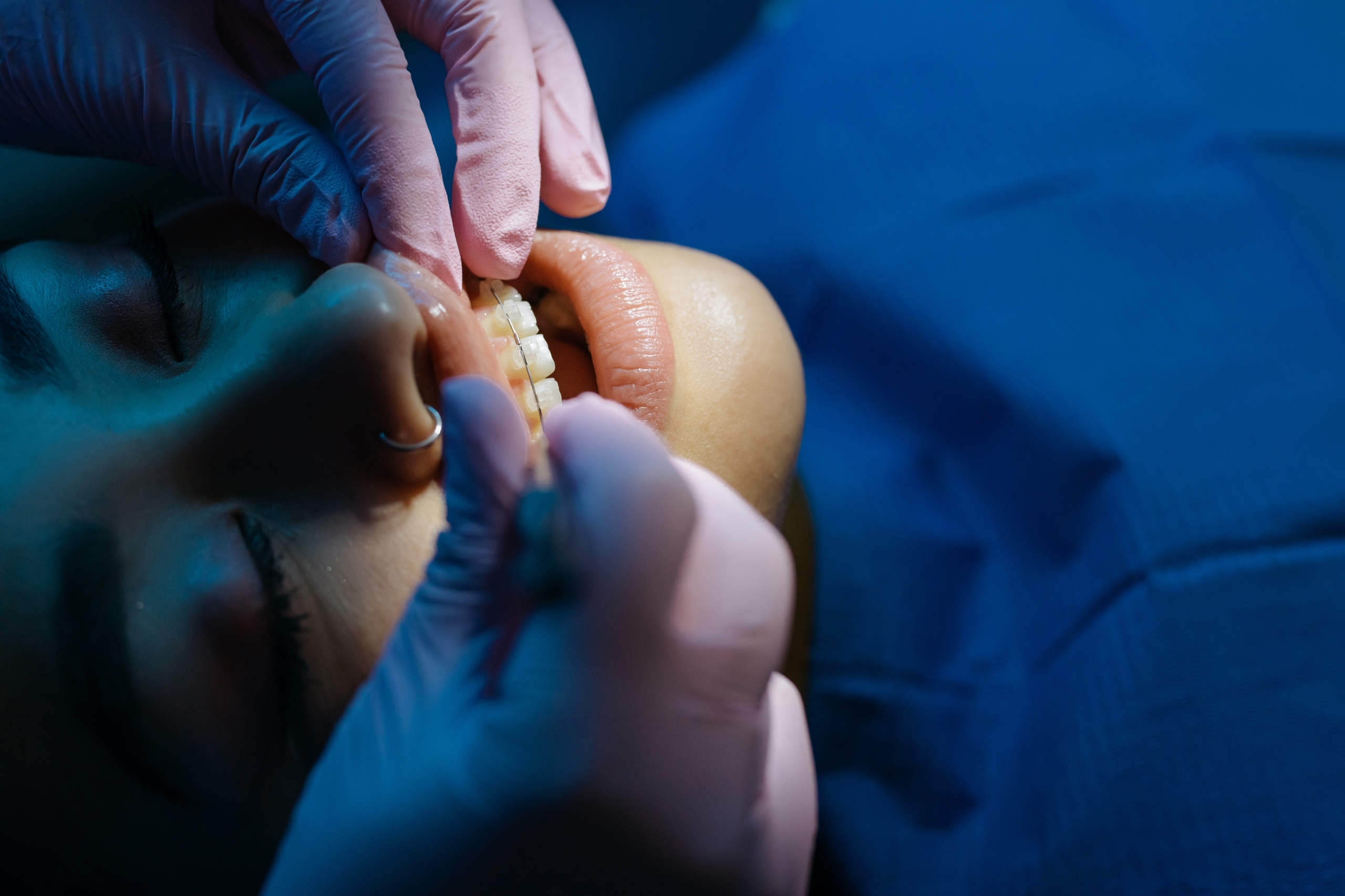 Private Dentistry in Berwick