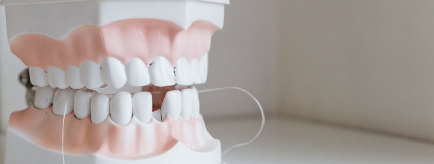 Dental Implants Berwick