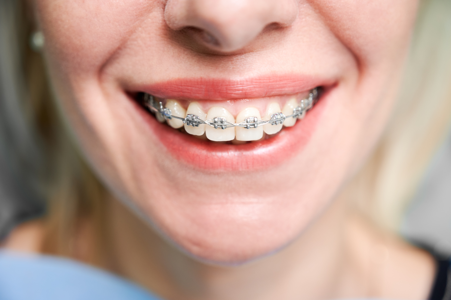 Orthodontic Treatments Berwick
