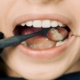 Teeth Whitening Berwick