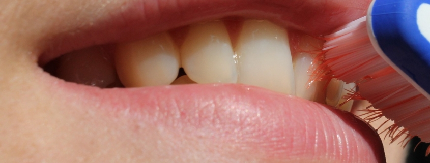Teeth Whitening Berwick
