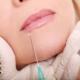 The Ultimate Experience: Lip Fillers in Berwick That Stand Out - Tweedmouth Dental Clinic