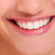 Teeth Whitening Berwick