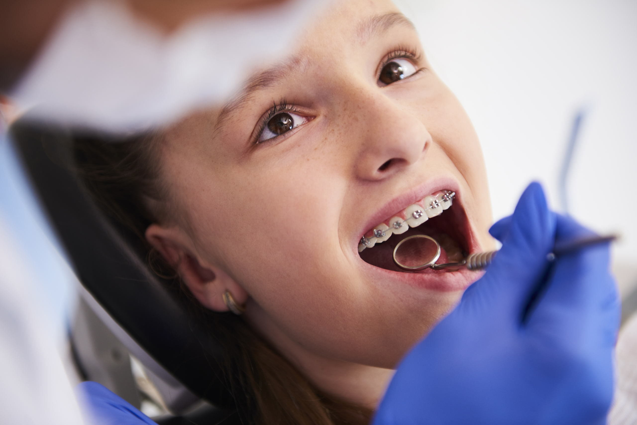 Why Clear Braces in Berwick Are the Choice for Modern Smiles - Tweedmouth Dental Clinic