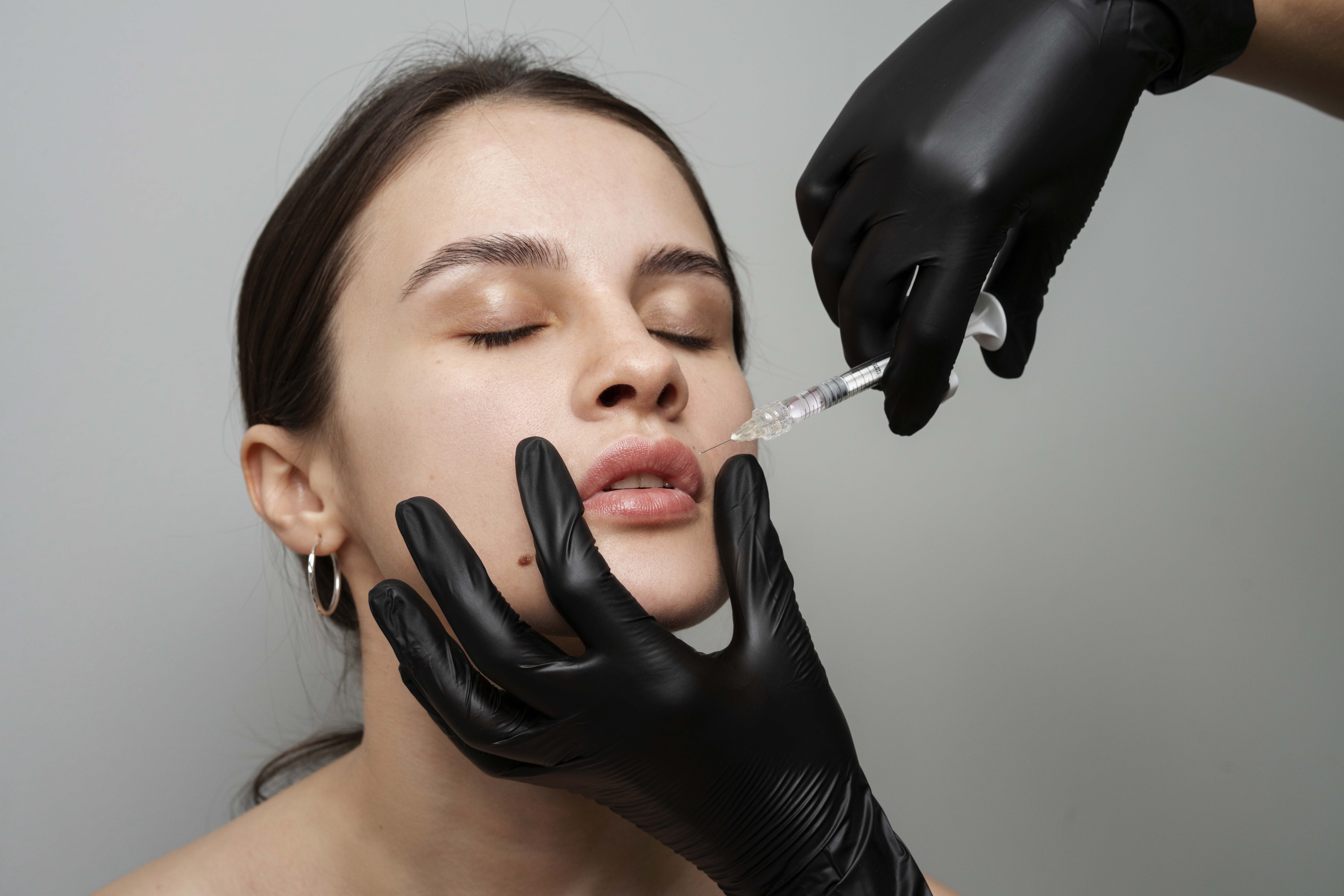 Lip Fillers Berwick
