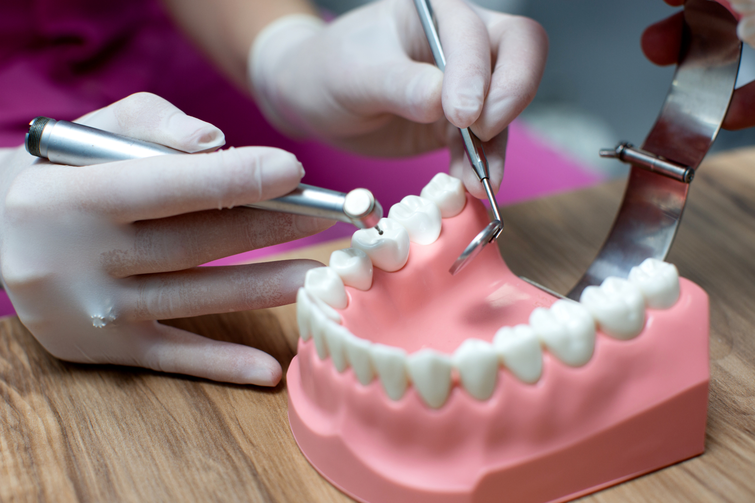 Dental Implants Berwick