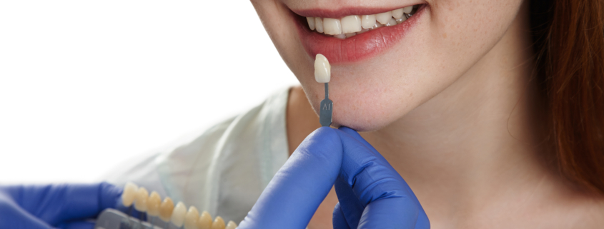 How Do Dental Implants Work Learn More at Tweedmouth Dental Clinic