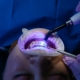 Orthodontic Braces in Berwick: What Types of Braces Are Right for Me? - Tweedmouth Dental Clinic