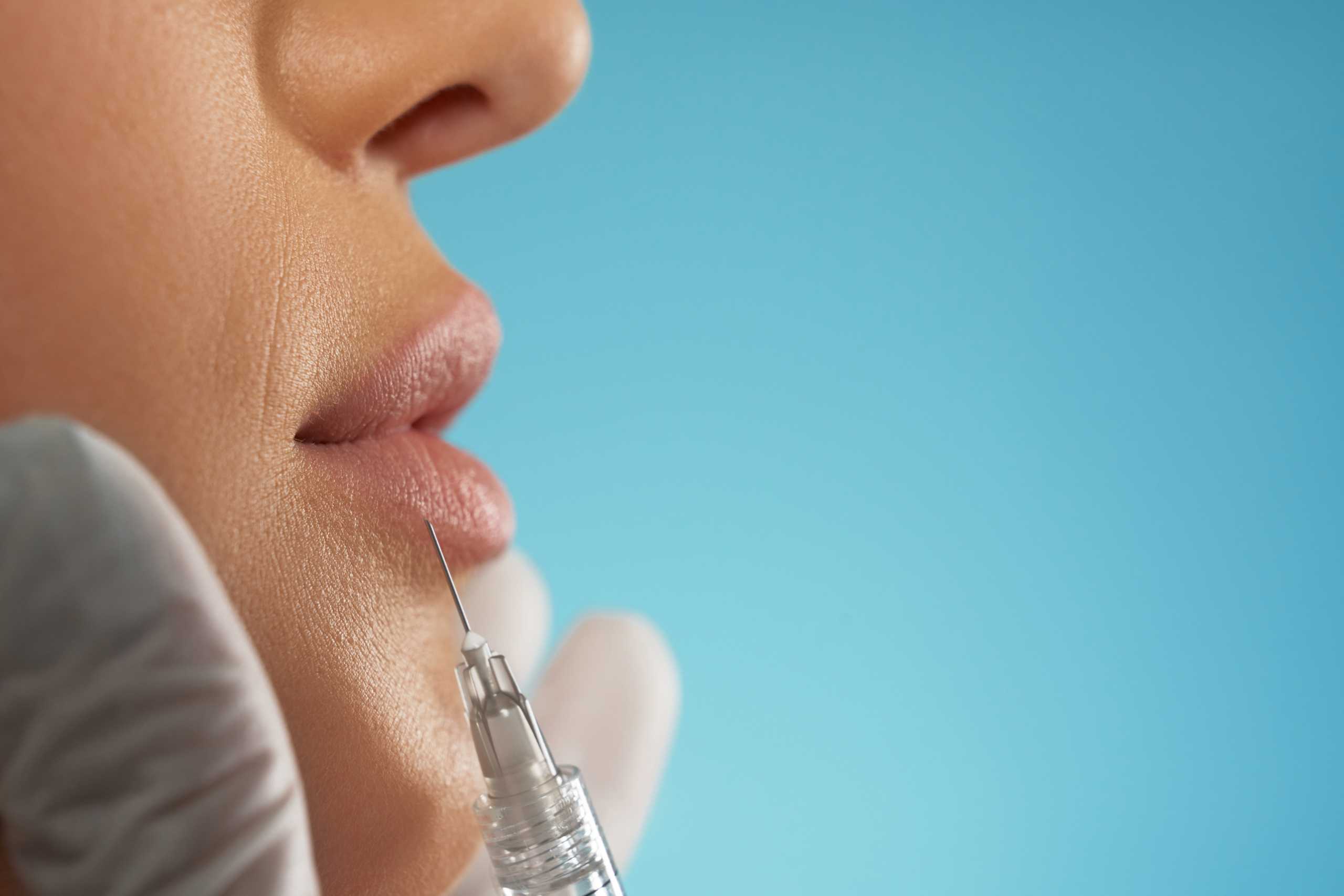 Achieve Fuller Lips with Professional Lip Fillers in Berwick - Tweedmouth Dental Clinic