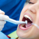 Everything You Need to Know About Dental Implants in Berwick